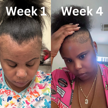 Reviora Miracle Drops